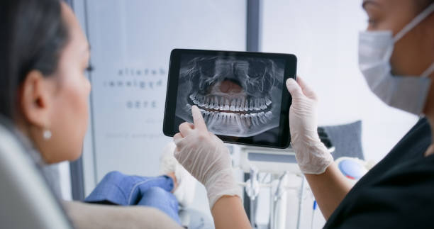 Licensed Tooth Extraction service in Santa Clara, CA - Smile Center Dentistry